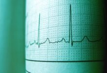 voicemail time slot analysis