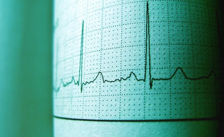 voicemail time slot analysis